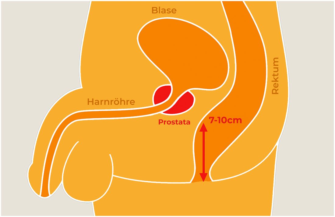 Grafik Prostata Ansicht